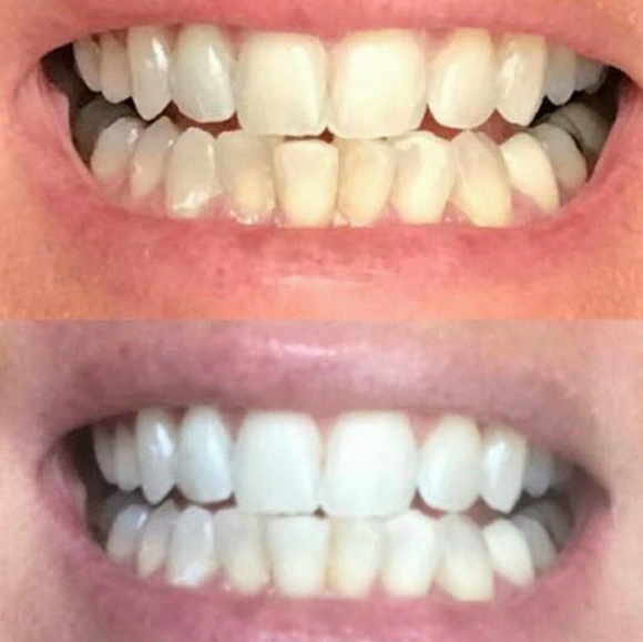 Whitening toothpaste - Picture 3 of 3